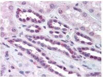 Immunohistochemistry: RelA/NFkB p65 [p Ser276] Antibody [NBP1-77807]